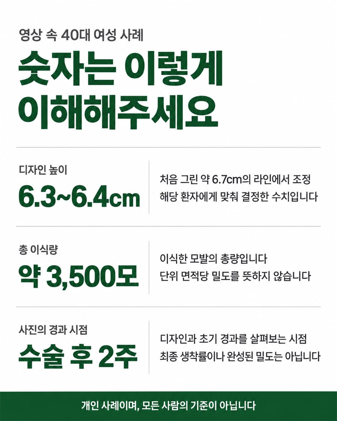 40多岁女性发际线案例的设计高度调整与约3500根移植方案概要