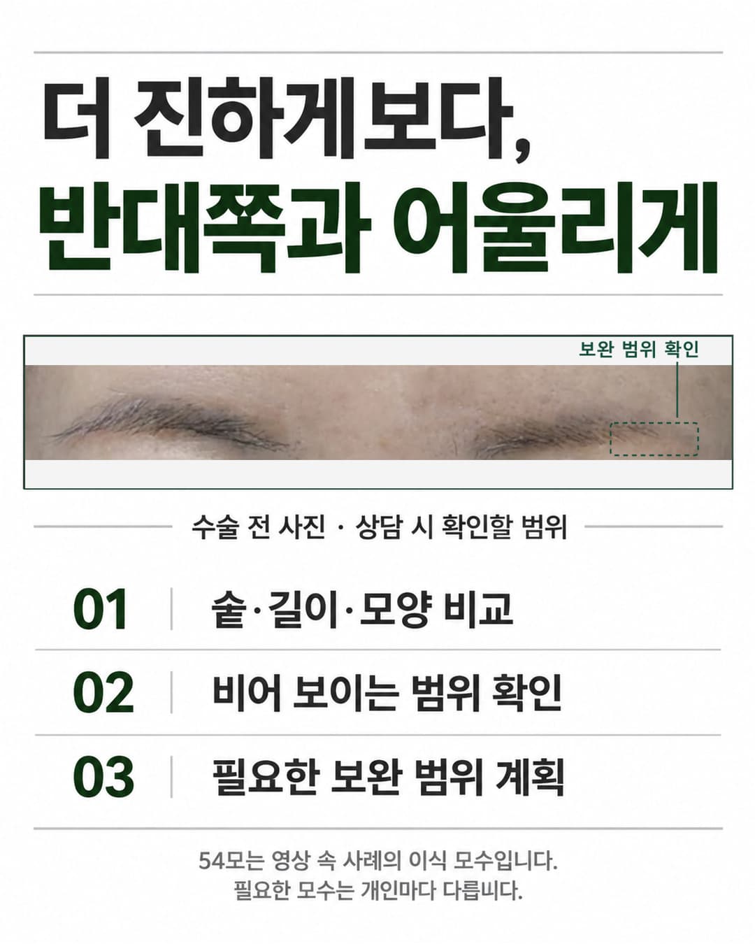 실제 수술 전 사진에서 눈썹 꼬리의 빈 부분을 확인하고 반대쪽과 숱·길이·모양을 비교하는 디자인 안내