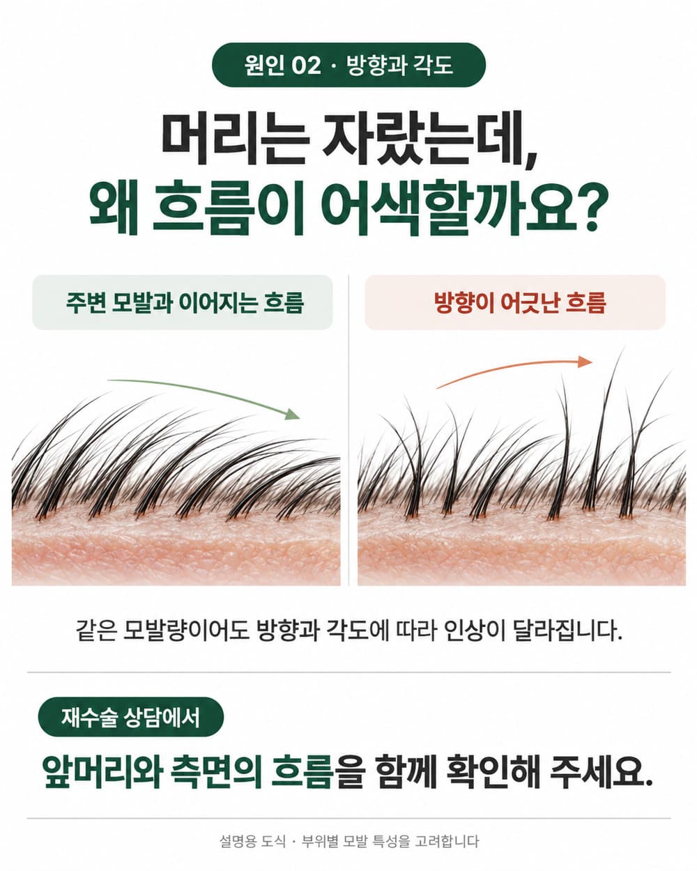 주변 모발과 흐름이 이어지는 배치와 방향이 어긋난 배치를 비교한 모발 방향과 각도 설명