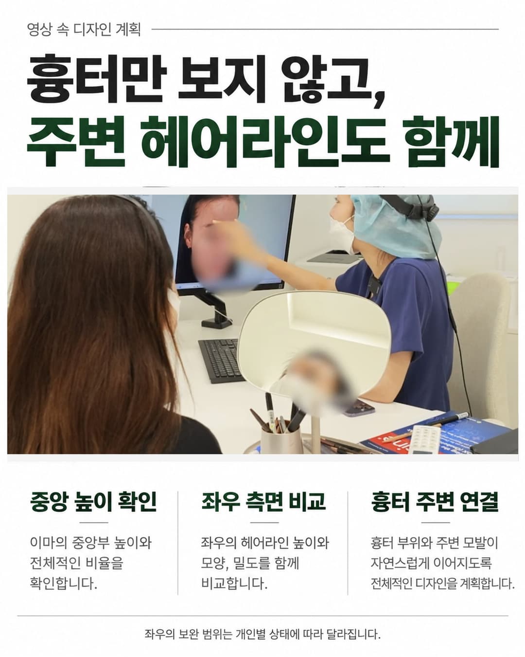 실제 영상의 상담 장면과 함께 중앙 높이, 좌우 측면, 흉터 주변 헤어라인 연결을 설명하는 이미지