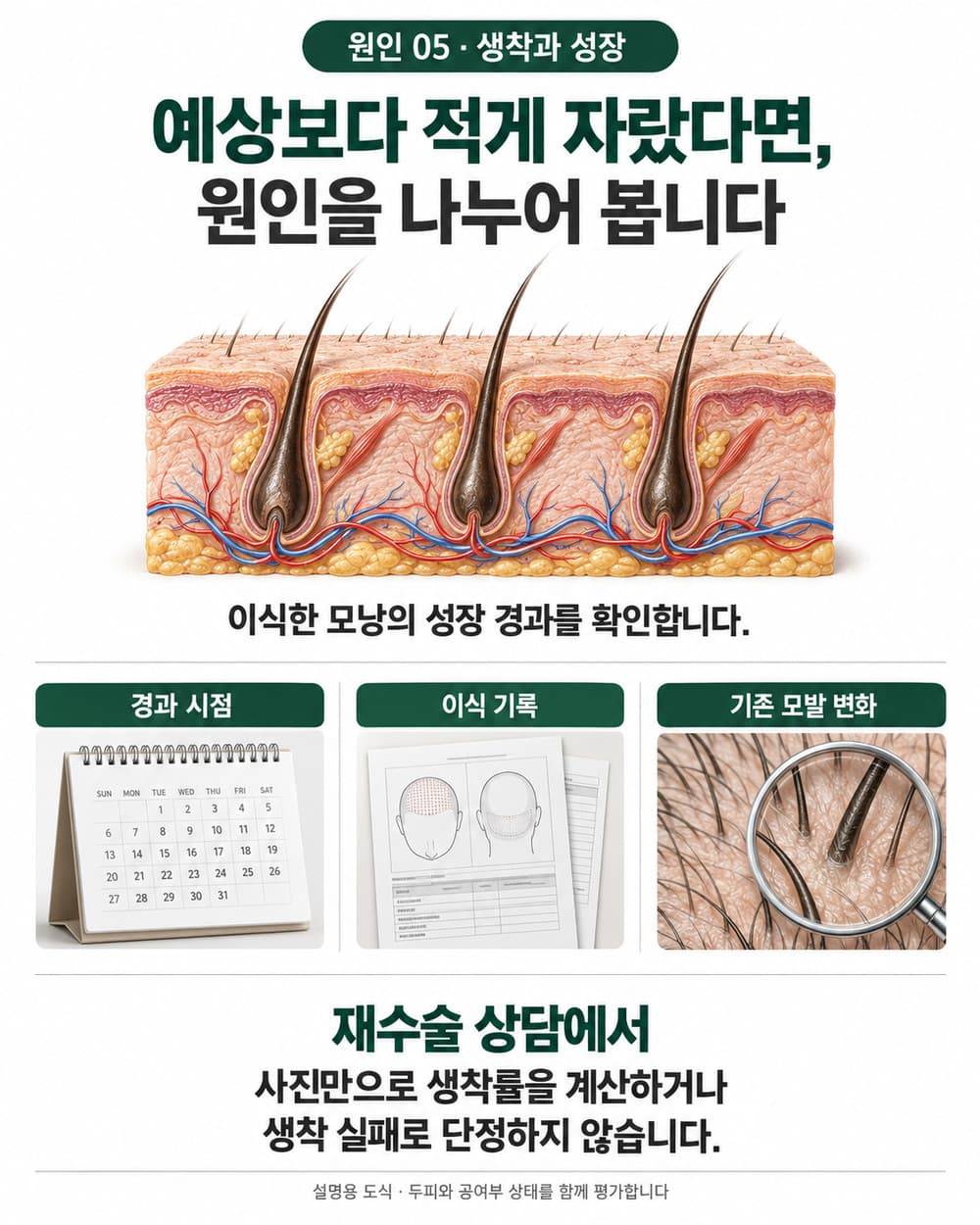 예상보다 모발이 적게 자랐을 때 경과 시점과 이식 기록 및 기존 모발 변화를 함께 확인하는 생착 상담 안내