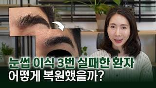 눈썹이식 3번 실패하고 더 어색해진 이유? 부자연스러운 눈썹 재수술 복원 솔루션