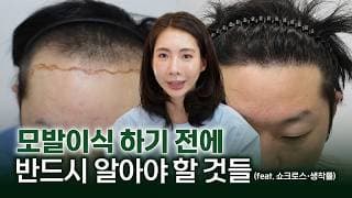 모발이식 A-Z 수술 원리, 절개vs비절개, 암흑기, 생착률 올려주는 4가지 보조치료 총정리!