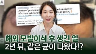 모발이식 해외에서 받으면 정말 괜찮을까? 저렴한 가격 뒤에 숨겨진 치명적 감염 위험과 실제 논문 사례 분석