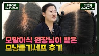 원장이 직접 받은 모낭줄기세포 치료 후기