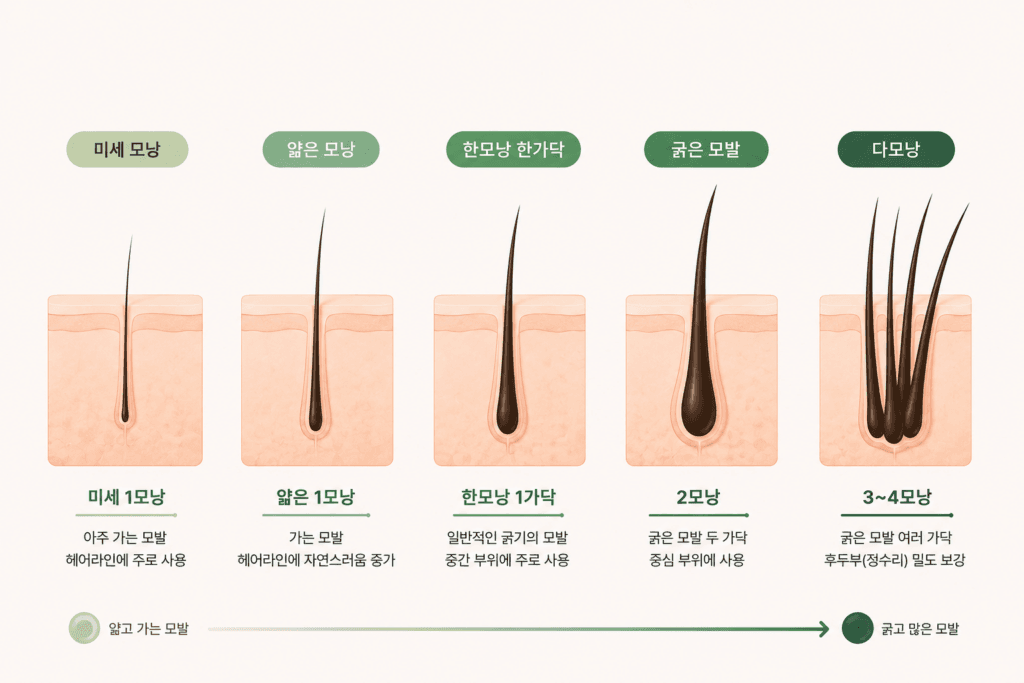 모발이식을 위한 모낭분류 종류