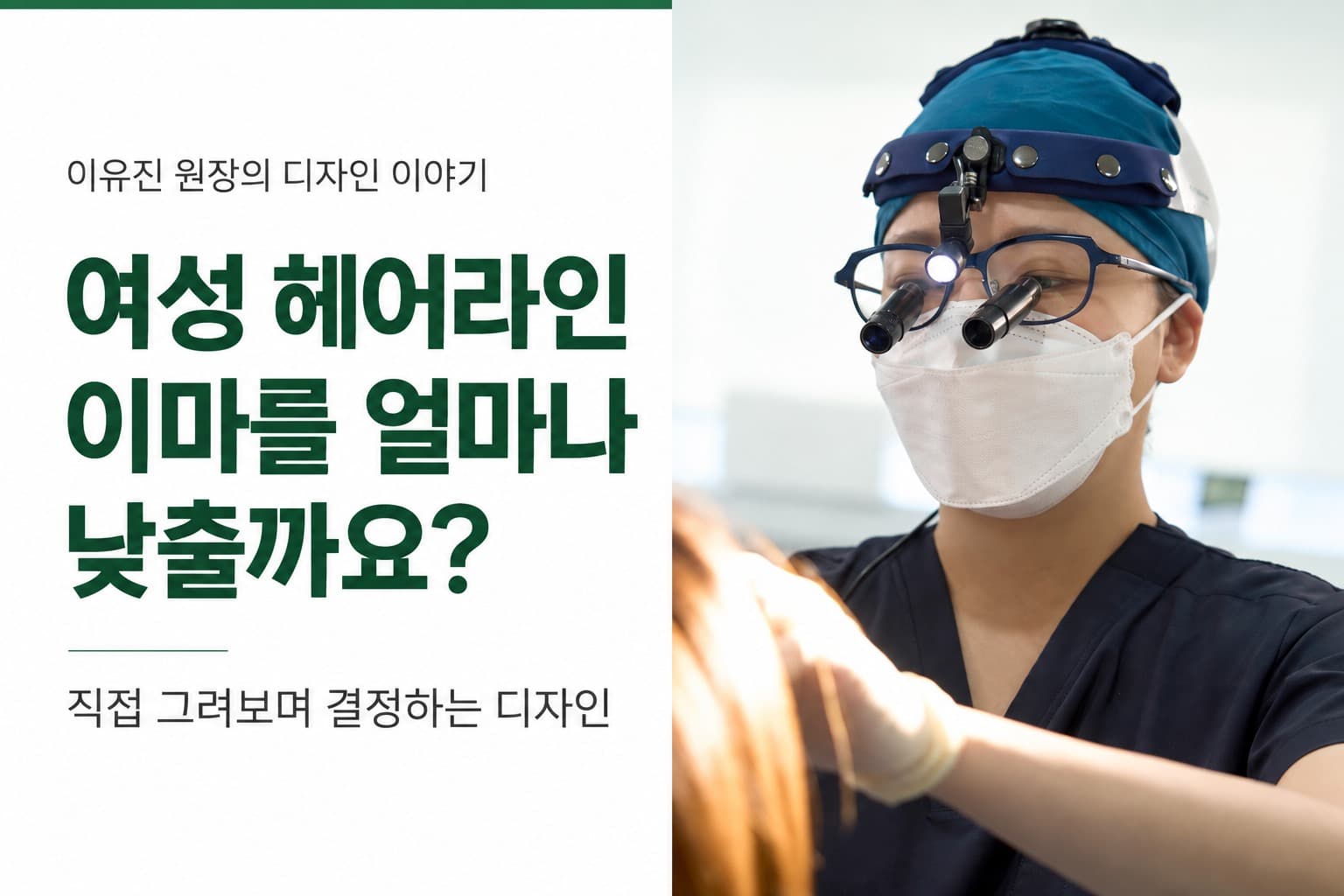 女性发际线毛发移植,比额头高度更重要的设计标准